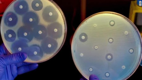 Placas de petri com cultivos de bactérias, sendo a imagem da esquerda uma representação de superbactérias. 